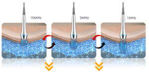 Three side-by-side panels of an ultrasound probe touching tissue at 10 MHz, 3 MHz, and 1 MHz, with curved arrows showing increasing depth penetration and orange chevrons beneath each panel.