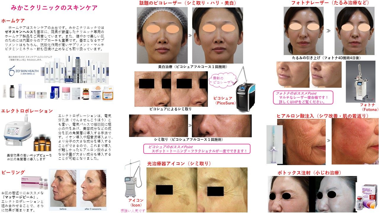 美肌治療のパンフレット みかこクリニック Mikako Clinic 形成外科 美容外科 美容皮膚科 一宮駅東口徒歩１分